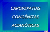 Cardiopatias Congênitas Acianóticas