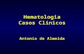 Hematologia Casos Clínicos Antonio de Almeida. Caso 1 Doente de 17 anos, sexo masculino, estudante Referenciado por odinofagia, febre e fadiga há uma.