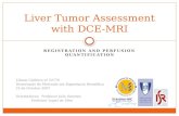 REGISTRATION AND PERFUSION QUANTIFICATION Liver Tumor Assessment with DCE-MRI Liliana Caldeira nº 52776 Dissertação de Mestrado em Engenharia Biomédica.