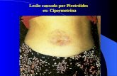 Lesão causada por Piretróides ex: Cipermetrina. LESÃO POR GLIFOSATO.