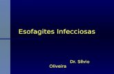 Esofagites Infecciosas Dr. Sílvio Oliveira Dr. Sílvio Oliveira.