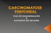 Carcinomatose peritoneal é a disseminação intra- peritoneal de células neoplásicas, sendo considerada a condição maligna mais comum da cavidade peritoneal.