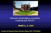 Alterações oftalmológicas secundárias a infecção pelo HTLV-1 André L. L. Curi Instituto de Pesquisa Clínica Evandro Chagas IPEC -FIOCRUZ.