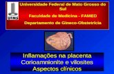 Inflamações na placenta Corioamnionite e vilosites Aspectos clínicos Universidade Federal de Mato Grosso do Sul Faculdade de Medicina - FAMED Departamento.