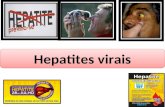 Hepatites virais. HEPATITES Doença inflamatória do fígado Inflamação dos hepatócitos ABCDEABCDE ABCDEABCDE Dengue Malária Toxoplasmose Mononucleose Citomegalovírus.