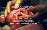 ESPINHA BÍFIDA NÚCLEO TEMÁTICO FISIOTERAPIA UNIBH Prof. Carlos Eduardo C.Silveira.