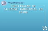 INFILTRAÇÃO DE SILICONE INDUSTRIAL EM PERNA. CASO 01.