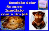 Escaldão Solar Socorro Imediato com a Su-Jok. A Su-Jok, é uma Terapêutica completa, e utiliza os mais variados processos, que contribuem para o bem estar.