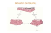 BIOLOGIA DO TUMOR. Tumores: Benignos Malignos bem diferenciados Malignos pouco diferenciados Anaplásicos Piora do prognóstico Diagnóstico morfológico.