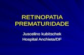 RETINOPATIA PREMATURIDADE Juscelino kubitschek Hospital Anchieta/DF.