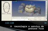 A tecnologia a serviço da prótese fixa CAD-CAM.  O desenho de uma estrutura protética num computador seguido da sua confecção por uma máquina de fresagem.