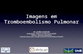 Imagens em Tromboembolismo Pulmonar Dr. Joalbo Andrade Radiologista - Doutor em Ciência pela FMUSP LifeScan - Medicina Diagnóstica Hospitais Santa Luzia,