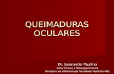 QUEIMADURAS OCULARES Dr. Leonardo Paulino Setor Córnea e Patologia Externa Disciplina de Oftalmologia Faculdade Medicina ABC.