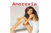 Anorexia. O que é anorexia? Anorexia é uma doença,em que o paciente está magro e se acha gordo, e quer emagrecer cada vez mais.