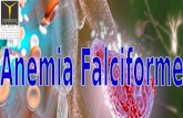 O que é a anemia falciforme? É uma doença hereditária Afecta a hemoglobina Muda a formula dos glóbulos vermelhos Existe um “entupimento” dos capilares.