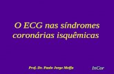 O ECG nas síndromes coronárias isquêmicas InCor Prof. Dr. Paulo Jorge Moffa.