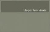 Hepatite viral Conceito: a hepatite viral ocorre quando um vírus causa infecção e inflamação do fígado. Os vírus que causam hepatite viral são denominados.