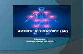Artrite reumatoide (ar)