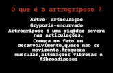 O Que é Artrogripose