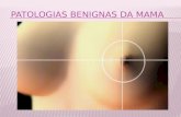 Patologia Benigna Da Mama[1]