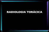 radiologia toráxica