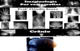 Aula 6 Imaginologia Por Radiografias Cranio Face - Prof Claudio Souza