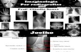 Aula 3 imaginologia por radiografias- Perna e joelho. Profº Claudio Souza