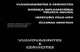 Infecções Genitais (Vulvovaginites, cervicites, DIPA, HPV e úlceras)