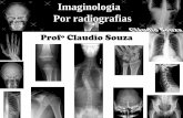 Aula 1 - Imaginologia por radiografias, mão, punho, cotovelo e antebraço. Profº Claudio Souza