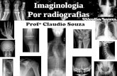 Aula 2 - Imaginologia por radiografias, Ombro e cintura escapular. Profº Claudio Souza- ATUALIZADA mês05/12!!!!