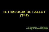 Tetralogia de Fallot (T4F)