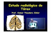 Aula 1   radiografia de tórax - 2014-2