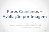 Nervos Cranianos - Avaliação por Imagem