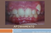 Apinhamento  ortopedia + ortodontia..
