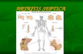 Artritis septica ppt