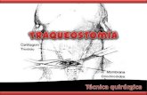 Traqueostomía: técnica quirúrgica