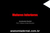 Molares Inferiores - Caique A. SIqueira - Anatomia Dental
