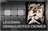 Leucemia granulocitica cronica