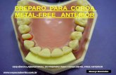 Preparo Dental para Coroa Metal Free Anterior