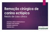 Remoção cirúrgica de canino ectópico - Exemplo de apresentação de caso clínico - Prof Ícaro Augusto - FAMAM