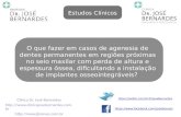 Implante: Estudos Clínicos Prof. Dr. José Bernardes - Clínica Dr. José Bernardes