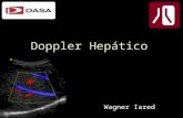 Doppler hepático
