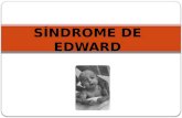 Sindrome de edward