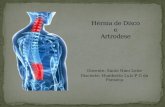 Hernia de Disco