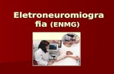 11° aula - Eletroneuromiografia (ENMG)