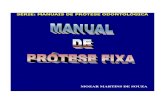 Manual de Protese Fixa (Mozar Martins)