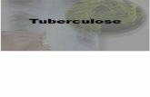 Tuberculose Pronto