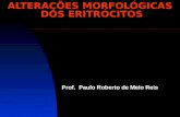 Aula 03_Alteracoes Morfologicas Dos Eritocitos