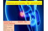 Adenocarcinoma de Próstata
