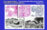 09/2002HEBR Fase aguda (2 dias) Fase de alveolitis fibrosante (14 dias) Aspirado de contenido gástrico Sepsis G(-)